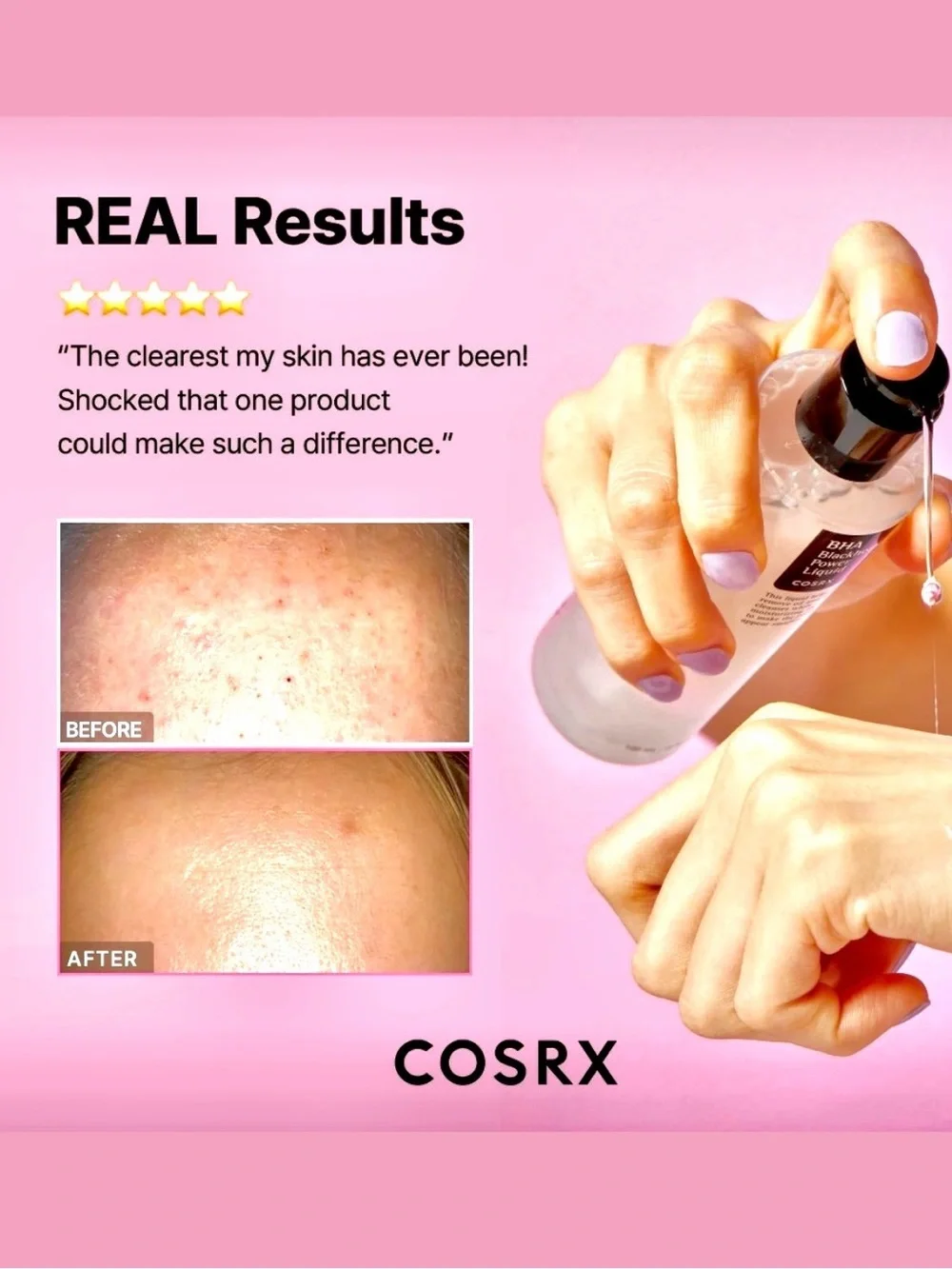 COSRX BHA Blackhead Power Liquid